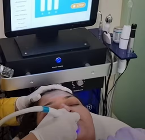 2025 multifunzione idro diamante Peeling acqua viso Micro dermoabrasione idra ossigeno rimozione punti neri e idratazione profonda - Product Image 2