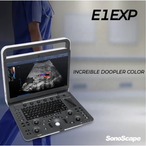 Échographe portable SonoScape E1 Exp avec Doppler couleur pour l'examen de l'abdomen, obstétrique/gynécologie, petites parties et vasculaire - Product Image 2