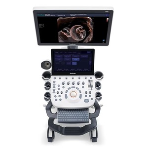 Ultrassom Colorido de Alta Frequência Sonoscape P20 Elite Tipo Carrinho para Exame Pré-Natal e Exclusão de Malformações Fetais - Product Image 5