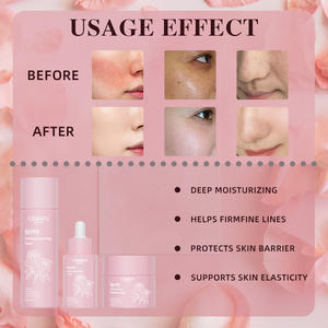 Private Label Niacinamide Verhelderende Anti Veroudering Rimpels Retinol Crème Serum <span class=keywords><strong>Rose</strong></span> Toner Gezichtsverzorging Set - Product Image 5