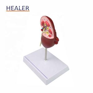 Modelo anatómico de riñón humano, modelo de piedra <span class=keywords><strong>renal</strong></span> de patología <span class=keywords><strong>renal</strong></span> de ciencia médica de PVC para uso escolar - Product Image 6