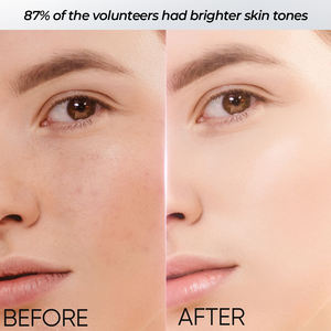 Masques faciaux en feuille de soin de la peau pour femmes coréennes en gros, <span class=keywords><strong>masque</strong></span> de soin de la peau du visage à la tomate, antioxydant, blanchissant, anti-âge, hydratant - Product Image 6