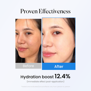 Suero facial <span class=keywords><strong>de</strong></span> ácido hialurónico orgánico, cuidado <span class=keywords><strong>de</strong></span> la piel antienvejecimiento para hidratación profunda, línea fina, aumento <span class=keywords><strong>de</strong></span> volumen, hidratación <span class=keywords><strong>de</strong></span> la piel, blanqueamiento - Product Image 5