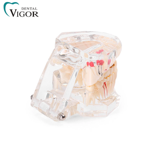 Modèle dentaire transparent pour l'enseignement de la pathologie dentaire avec dents amovibles pour la démonstration de prothèses - Product Image 3