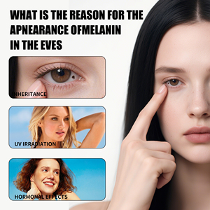 Anti Dark Circle Eye Cream Eye Strain Masajeador borroso y Fadedroller Cuidado DE LA PIEL Belleza Salud Suero para los ojos - Product Image 3