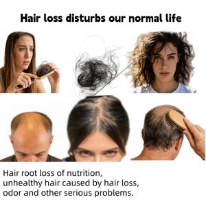 Champú Orgánico <span class=keywords><strong>de</strong></span> Jengibre Anticaída, Limpieza Profunda del Cuero Cabelludo, Cuidado Capilar, Champú <span class=keywords><strong>para</strong></span> el Crecimiento del <span class=keywords><strong>Cabello</strong></span> - Product Image 6