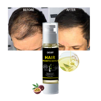 Logo personnalisé marque privée biotine aide à la croissance des cheveux huile de sérum anti-chute pour la croissance des poils incarnés