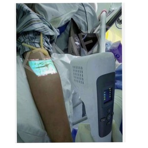 Alat Pencari Vena Portabel Medis Inframerah untuk Manusia, Hewan, dan Tubuh, Perangkat Pencari Vena Veteriner - Product Image 6