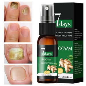 Marque Blanche 2025 Nouvelle Arrivée Spray Anti-<span class=keywords><strong>Mycose</strong></span> des Ongles 7 Jours Répare les Ongles et Cuticules Endommagés Produits de Soin 30ml MOOYAM Spray Ongles - Product Image 1