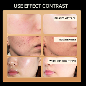 Medico in Silicone per la cura della pelle del viso ha portato la luce maschera rossa a infrarossi LED maschera per uso domestico attrezzatura di bellezza - Product Image 6