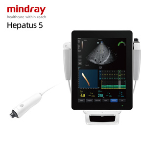 Ecógrafo Doppler Mindray Hepatus 5 3D/<span class=keywords><strong>4D</strong></span>/<span class=keywords><strong>5D</strong></span> de Última Generación en Carro, Económico <span class=keywords><strong>y</strong></span> de Bajo Precio - Product Image 1