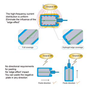 Plaques de mise à la terre électriques jetables en mousse bleue pour ESU, plaque négative bipolaire à usage chirurgical Valleylab avec câble de 3,0 m - Product Image 5