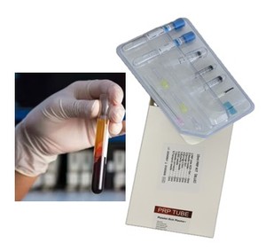 Kit de centrifugation vétérinaire PRP/PRF/GFC |   Dispositif médical stérile pour concentré de facteurs de croissance et cicatrisation des plaies - Expédition rapide - Product Image 3