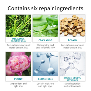 Loción Vegana Herbal Mineral para Reparación del Acné y Blanqueamiento, <span class=keywords><strong>a</strong></span> <span class=keywords><strong>Base</strong></span> <span class=keywords><strong>de</strong></span> <span class=keywords><strong>Agua</strong></span>, Cuidado OEM para Piel Seca, Gel <span class=keywords><strong>Facial</strong></span> Orgánico <span class=keywords><strong>de</strong></span> Peoní<span class=keywords><strong>a</strong></span> y Árbol <span class=keywords><strong>de</strong></span> Té - Product Image 3