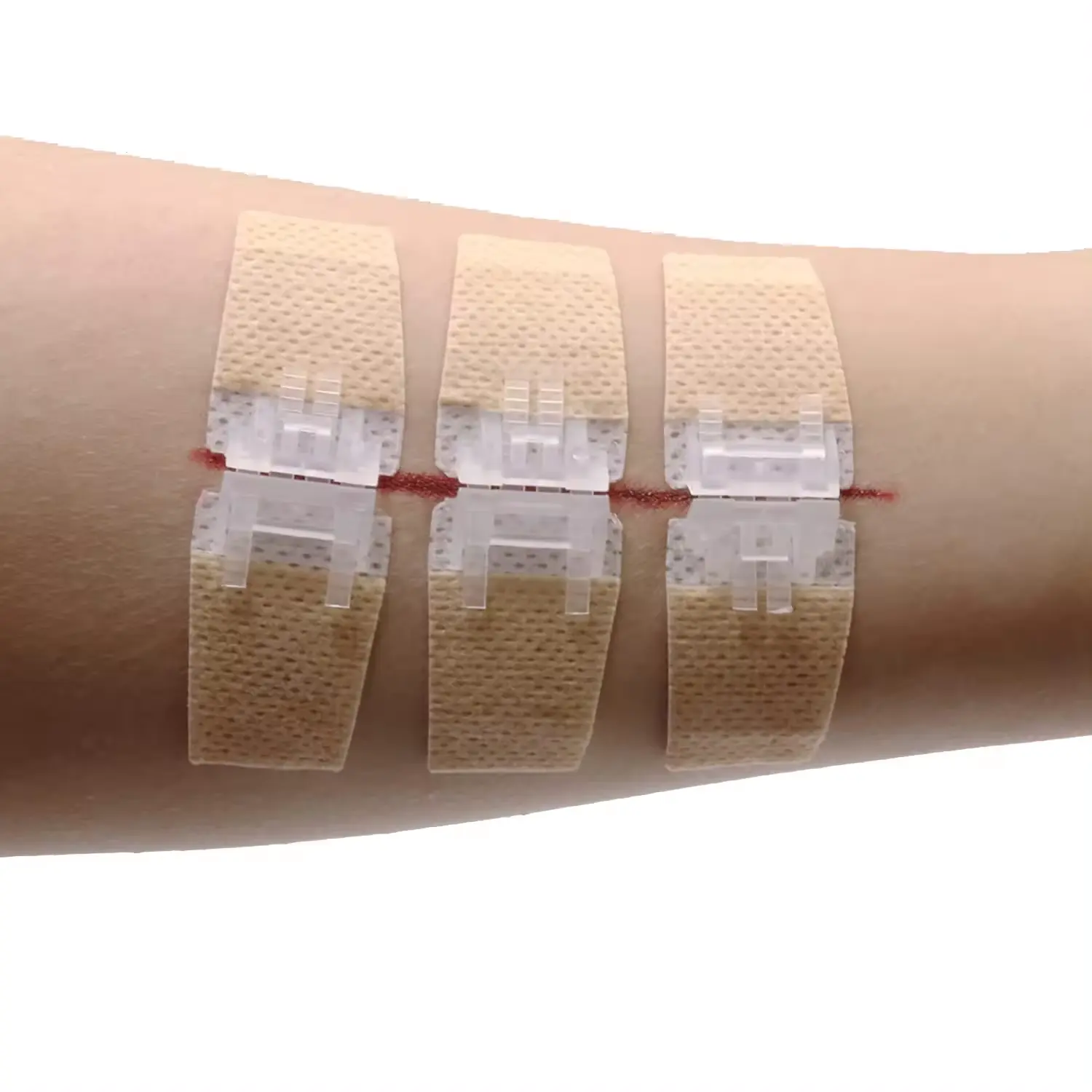 Dispositivo di chiusura per ferite Non tessute dispositivo di chiusura per ferite mediche