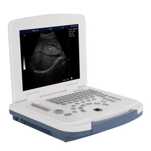 Échographe vétérinaire portable léger de type ordinateur portable pour le diagnostic de gestation des animaux d'élevage, noir et blanc - Product Image 2
