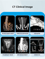 Appareil CBCT vétérinaire OSCAT 4 en 1, générateur haute fréquence 15 kW, équipement vétérinaire, appareil de radiographie médicale pour animaux, clinique vétérinaire