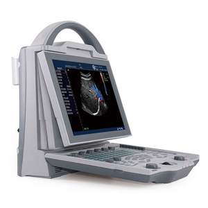 Machine à ultrasons portable la moins chère Ordinateur portable Couleur Machine de thérapie par ultrasons 3D Prix pas cher pour l'homme - Product Image 5