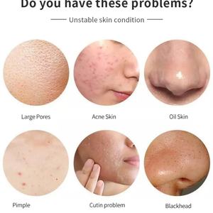 เซรั่มบำรุงผิวหน้าสูตรเฉพาะ OEM พร้อมโลโก้ส่วนตัว ไฮยาลูรอน วิตามินซี เรตินอล คอลลาเจนจากเมือกหอยทาก ไนอะซินาไมด์ - Product Image 2