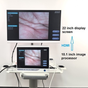 กล้องเอ็นโดสโคปสัตวแพทย์สำหรับสุนัข รุ่นขายส่งราคาพิเศษสำหรับโรงพยาบาลสัตว์ พร้อมเครื่องตรวจทางเดินอาหารและลำไส้ใหญ่ขั้นสูง - Product Image 3