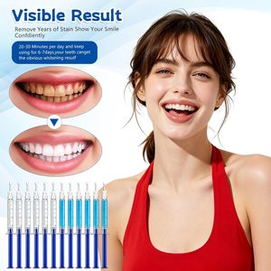 Kit de 12 Jeringas de Gel Blanqueador Dental, Recargas de Gel Blanqueador de 3 ml para Dientes Sensibles, Funciona con Luz LED y Bandeja - Product Image 6