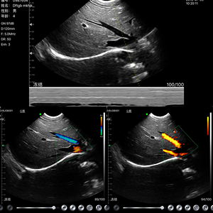 Konted MDRCE mesin <span class=keywords><strong>Doppler</strong></span> warna nirkabel, WIFI & USB pemeriksaan cembung 128 elemen 3.5Mhz Probe Ultrasound C10UR - Product Image 6