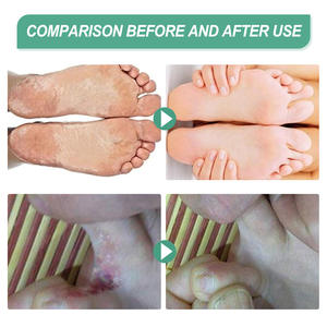 South Moon Herbal Rafraîchissant <span class=keywords><strong>Pieds</strong></span> Peeling Anti Fongique Odeur Dissolvant Déodorant <span class=keywords><strong>Pieds</strong></span> Désodorisant Spray - Product Image 2