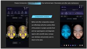 Analizador de Piel 3D con 3 Cámaras y Tecnología de IA, Escáner Facial 3D con 48 Millones de Píxeles, Precio de Fábrica 2025 - Product Image 6