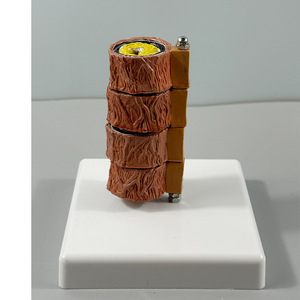 Model Anatomi Pembentukan Trombus Aterosklerosis Arteri Cabang Tubuh Manusia untuk Departemen Hematologi Vaskular Model LYA-002 - Product Image 4