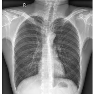 Équipements médicaux à rayons X à haute sensibilité <span class=keywords><strong>Radiologie</strong></span> hospitalière durable Détecteur à écran plat filaire médical 14*17 pour usage humain - Product Image 6