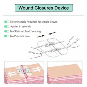 Best Quality China Manufacturer Knee Pain Relief - Product Image 2