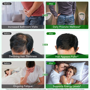 SOLOTREE Bitkisel Özlü Erkek Prostat Desteği <span class=keywords><strong>Saw</strong></span> <span class=keywords><strong>Palmetto</strong></span> Sıvı Damlaları Toptan Saç Çıkaran <span class=keywords><strong>Saw</strong></span> <span class=keywords><strong>Palmetto</strong></span> Takviye Edici Gıda - Product Image 4