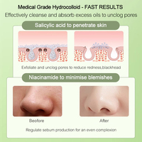 Patch nasal hydrocolloïde végétalien biodégradable dissolvant de tête noire nettoyant hydrocolloïde pores de points noirs patch de dissolvant de bandelettes nasales