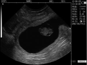 Pemindai Ultrasound Peternakan Hewan Dokter Hewan, Pemindai Gema Portabel L60 untuk Pemindai Kuda Domba Babi Sapi - Product Image 5
