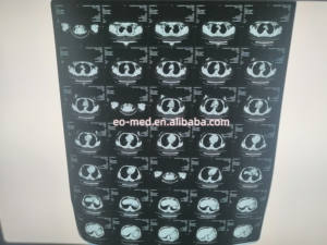 Imager térmico portátil <span class=keywords><strong>x-ray</strong></span> para xray, impressora de filme seco barato preço - Product Image 6