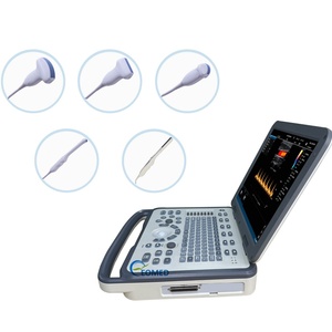 เครื่องอัลตราซาวนด์สำหรับคนและสัตว์ที่เชื่อถือได้ พร้อมคีย์บอร์ดตามหลักสรีรศาสตร์ และระบบจัดการภาพที่ครบครัน เครื่องสแกนอัลตราซาวนด์ PW,PDI รุ่น CU36 - Product Image 2