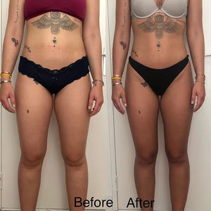 Endos Slimming <b>Machine</b> Skin Firming Massager for Face Body Breast Lymphatic Drainage <b>Machine</b> Inner Ball Roller Massager - Product Image 6