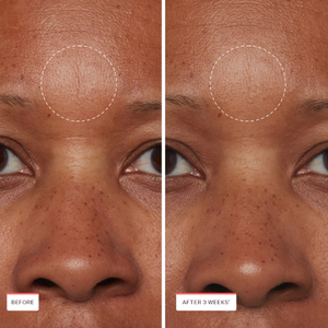 Sérum Raffermissant au Cuivre et Peptides OEM ODM - Sérum Visage Anti-Âge pour Rides et Peau Relâchée, Stimulant de Collagène, Alternative au Rétinol - Product Image 4