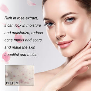 น้ำมันหอมระเหยกุหลาบสำหรับนวด 60 มล. กลิ่นหอมเข้มข้น หรูหรา เนื้อบางเบา ไม่เหนียวเหนอะหนะ  ลดราคาพิเศษ - Product Image 3