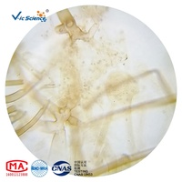 Lames de microscope préparées pour la botanique des plantes, spécimens de Rhizopus nigricans