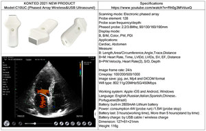 Cardíaco Doppler portátil de la máquina de ultrasonido precio médica <span class=keywords><strong>Sonar</strong></span> 2d 3d 4d ecocardiografía Ecografo Usd eco máquina - Product Image 6