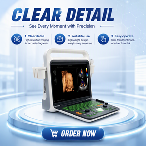Sistema de Ultrasonido Profesional HD 3D 4D de 15 Pulgadas con Función Doppler PW CW para Aplicaciones de Cardiología - Product Image 1