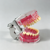 Modèle dentaire SCIEDU avec gencives souples amovibles, dents extractibles, modèle d'entraînement à l'extraction dentaire pour la formation des dentistes