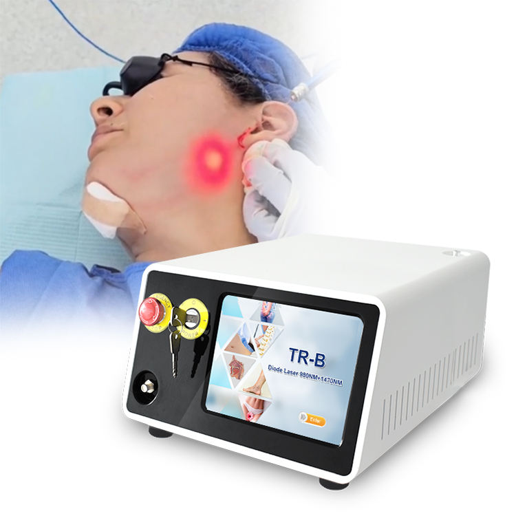 Endolift Lifting Facial Laser Precio Láser Endolift Soluciones