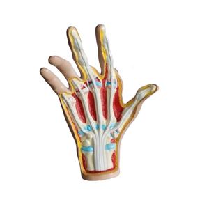 Démonstrato clinique de main de simulateur de pathologie pour l'enseignement orthopédique et rhumatologique - Product Image 5