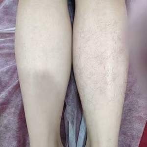 Appareil de suppression des poils et de rajeunissement de la peau au laser diode à 3 longueurs d'onde de bureau 755 nm/808 nm/1064 nm Utilisation commerciale Matériel ABS - Product Image 5