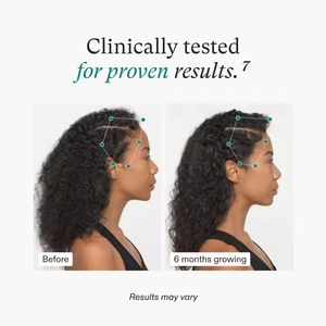 Gli <span class=keywords><strong>integratori</strong></span> <span class=keywords><strong>per</strong></span> la crescita dei <span class=keywords><strong>capelli</strong></span> delle donne clinicamente collaudati <span class=keywords><strong>per</strong></span> <span class=keywords><strong>capelli</strong></span> a base di erbe capsule <span class=keywords><strong>per</strong></span> adulti raggiungono un integratore <span class=keywords><strong>per</strong></span> <span class=keywords><strong>capelli</strong></span> più spesso e più forte - Product Image 3