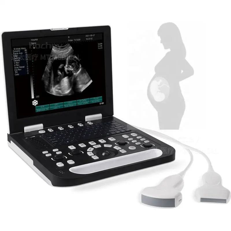 MT Medical Equipment Portable 15 Inches LCD Display Full Digital Laptop Vet Ultrasound Animal Scanner Machine