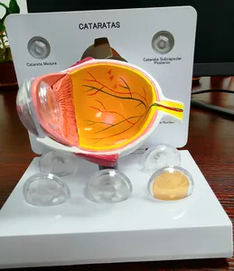 Avançamento da ciência médica olho anatômico, 6 peças 3d de plástico cataracts modelo de olho para treinamento educacional