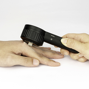IBOOLO DE-3100 analyseur de peau de dermatoscopie haute HD <span class=keywords><strong>dermatoscope</strong></span> portable et compatible smartphone - Product Image 4